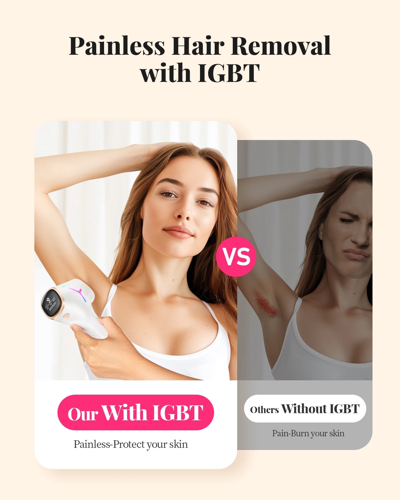 IPL Hair Removal Device -- 990,000 Flashes, 9 Levels, Full Body Use for Women & Men