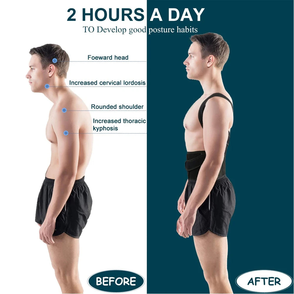 Back Brace Posture Corrector with Metal Support Bars | Adjustable for Men & Women